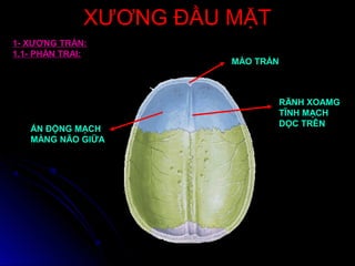 XƯƠNG ĐẦU MẶTXƯƠNG ĐẦU MẶT
MÀO TRÁN
RÃNH XOAMG
TĨNH MẠCH
DỌC TRÊN
ẤN ĐỘNG MẠCH
MÀNG NÃO GIỮA
1- XƯƠNG TRÁN:
1.1- PHẦN TRAI:
 