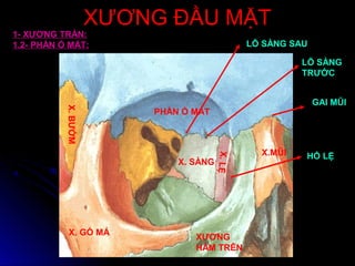 XƯƠNG ĐẦU MẶTXƯƠNG ĐẦU MẶT
PHẦN Ổ MẮT
XƯƠNG
HÀM TRÊN
X.MŨI
X. GÒ MÁ
X. SÀNG
X.LỆ
X.BƯỚM LỖ SÀNG
TRƯỚC
LỖ SÀNG SAU
GAI MŨI
HỐ LỆ
1- XƯƠNG TRÁN:
1.2- PHẦN Ổ MẮT:
 
