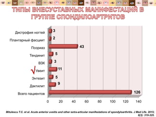 0 20 40 60 80 100 120 140
Всего пациентов
Дактилит
Энтезит
Увеит
ВЗК
Тендинит
Псориаз
Плантарный фасциит
Дистрофия ногтей
126
9
5
11
3
5
43
2
3
Mitulescu T.C. et al. Acute anterior uveitis and other extra-articular manifestations of spondyloarthritis. J Med Life. 2015;
8(3): 319-325.

 