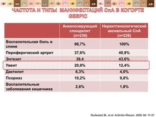 Анкилозирующий
спондилит
(n=236)
Нерентгенологический
аксиальный СпА
(n=226)
Воспалительная боль в
спине
98,7% 100%
Периферический артрит 37,6% 40,9%
Энтезит 39,4 43,6%
Увеит 20,9% 12,4%
Дактилит 6,3% 4,0%
Псориаз 10,2% 9,8%
Воспалительные
заболевания кишечника
2,6% 1,8%
Rudwaleit M., et al. Arthritis Rheum. 2009; 60: 17-27
 