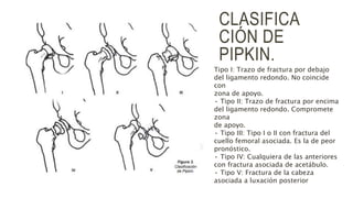 CLASIFICA
CIÓN DE
PIPKIN.
Tipo I: Trazo de fractura por debajo
del ligamento redondo. No coincide
con
zona de apoyo.
• Tipo II: Trazo de fractura por encima
del ligamento redondo. Compromete
zona
de apoyo.
• Tipo III: Tipo I o II con fractura del
cuello femoral asociada. Es la de peor
pronóstico.
• Tipo IV: Cualquiera de las anteriores
con fractura asociada de acetábulo.
• Tipo V: Fractura de la cabeza
asociada a luxación posterior
 