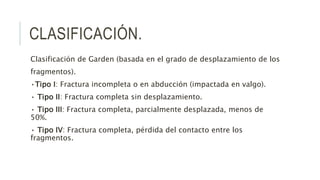 CLASIFICACIÓN.
Clasificación de Garden (basada en el grado de desplazamiento de los
fragmentos).
•Tipo I: Fractura incompleta o en abducción (impactada en valgo).
• Tipo II: Fractura completa sin desplazamiento.
• Tipo III: Fractura completa, parcialmente desplazada, menos de
50%.
• Tipo IV: Fractura completa, pérdida del contacto entre los
fragmentos.
 