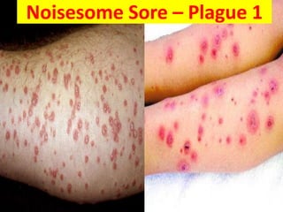 Noisesome Sore – Plague 1
 