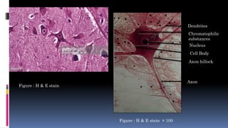 Dendrites
Chromatophilic
substances
Nucleus
Cell Body
Axon hillock
Axon
Figure : H & E stain
Figure : H & E stain × 100
 