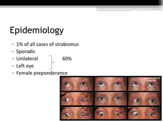 Epidemiology
• 1% of all cases of strabismus
• Sporadic
• Unilateral 60%
• Left eye
• Female preponderance
 