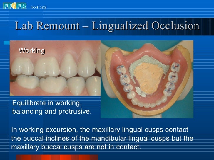28.laboratory remount