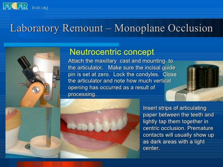 28.laboratory remount