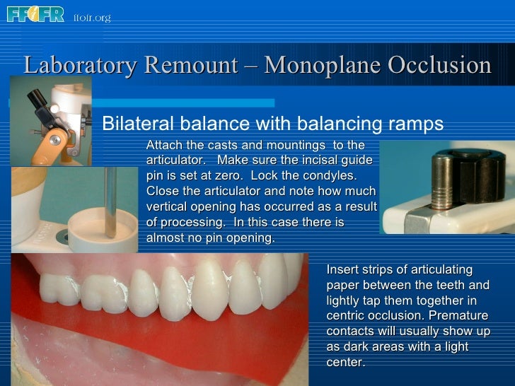 28.laboratory remount