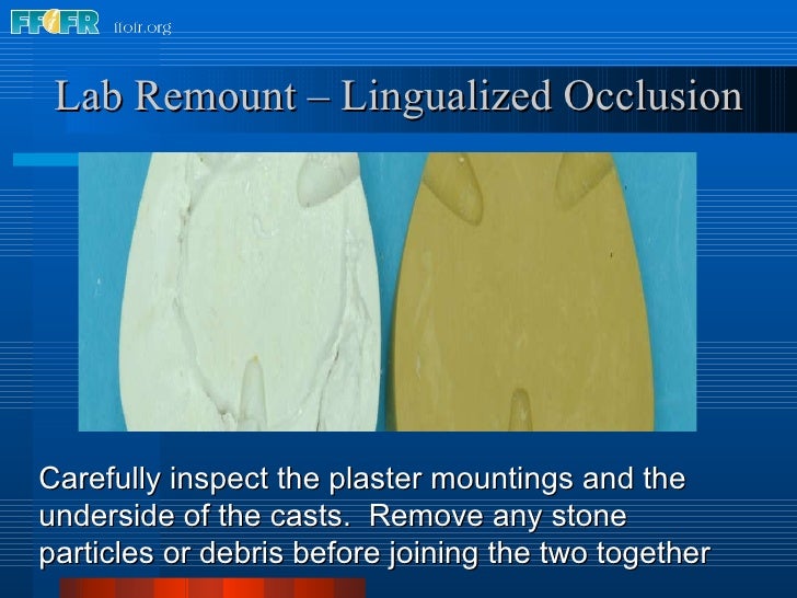 28.laboratory remount