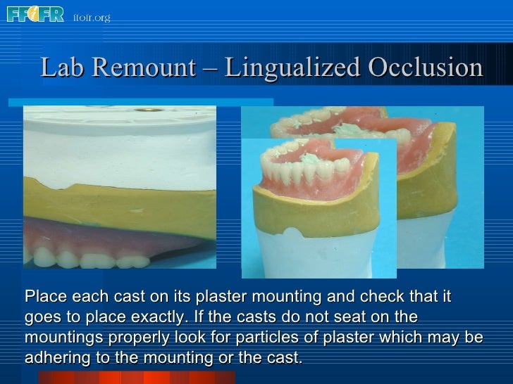 28.laboratory remount