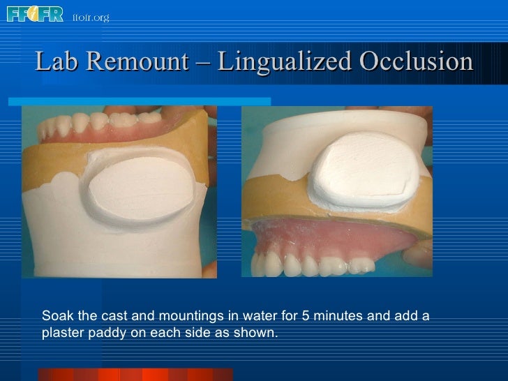 28.laboratory remount