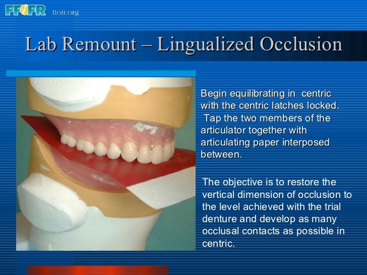 28.laboratory remount