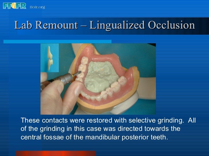 28.laboratory remount