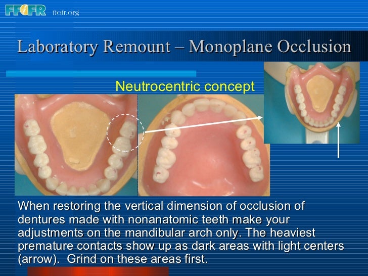 28.laboratory remount