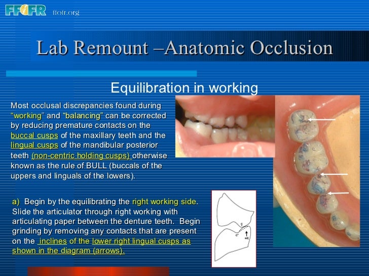 28.laboratory remount