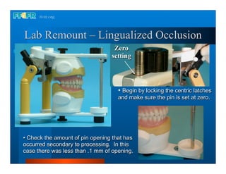 Lab Remount – Lingualized Occlusion
                                  Zero
                                 setting




                                    • Begin by locking the centric latches
                                    and make sure the pin is set at zero.




• Check the amount of pin opening that has
occurred secondary to processing. In this
case there was less than .1 mm of opening.
 