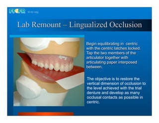 Lab Remount – Lingualized Occlusion

                   Begin equilibrating in centric
                   with the centric latches locked.
                   Tap the two members of the
                   articulator together with
                   articulating paper interposed
                   between.

                   The objective is to restore the
                   vertical dimension of occlusion to
                   the level achieved with the trial
                   denture and develop as many
                   occlusal contacts as possible in
                   centric.
 