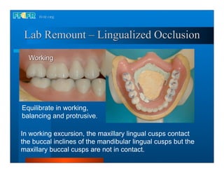 Lab Remount – Lingualized Occlusion
  Working




Equilibrate in working,
balancing and protrusive.

In working excursion, the maxillary lingual cusps contact
the buccal inclines of the mandibular lingual cusps but the
maxillary buccal cusps are not in contact.
 