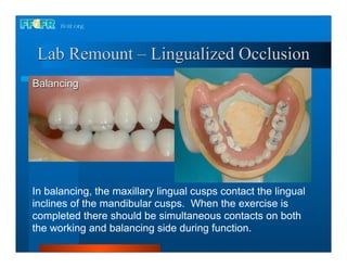 Lab Remount – Lingualized Occlusion
Balancing




In balancing, the maxillary lingual cusps contact the lingual
inclines of the mandibular cusps. When the exercise is
completed there should be simultaneous contacts on both
the working and balancing side during function.
 