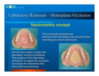 Laboratory Remount – Monoplane Occlusion

                  Neutrocentric concept

                            The processed dentures are
                            removed from the flasks and secured to the
                            mountings as shown previously.




 We are now ready to begin the
 laboratory remount procedure.
 The purpose of the laboratory
 remount is to adjust the occlusion
 to account for distortions that
 occur during processing.
 