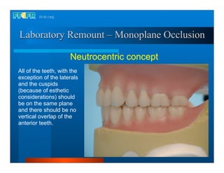 Laboratory Remount – Monoplane Occlusion

                      Neutrocentric concept
All of the teeth, with the
exception of the laterals
and the cuspids
(because of esthetic
considerations) should
be on the same plane
and there should be no
vertical overlap of the
anterior teeth.
 