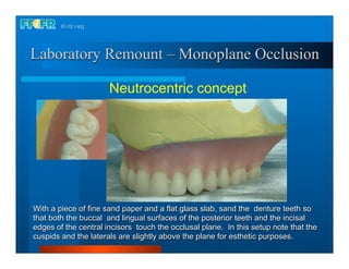 Laboratory Remount – Monoplane Occlusion

                      Neutrocentric concept




With a piece of fine sand paper and a flat glass slab, sand the denture teeth so
that both the buccal and lingual surfaces of the posterior teeth and the incisal
edges of the central incisors touch the occlusal plane. In this setup note that the
cuspids and the laterals are slightly above the plane for esthetic purposes.
 