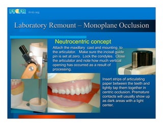 Laboratory Remount – Monoplane Occlusion

            Neutrocentric concept
           Attach the maxillary cast and mounting to
           the articulator. Make sure the incisal guide
           pin is set at zero. Lock the condyles. Close
           the articulator and note how much vertical
           opening has occurred as a result of
           processing.

                                         Insert strips of articulating
                                         paper between the teeth and
                                         lightly tap them together in
                                         centric occlusion. Premature
                                         contacts will usually show up
                                         as dark areas with a light
                                         center.
 