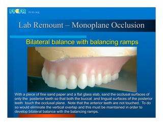 Lab Remount – Monoplane Occlusion

       Bilateral balance with balancing ramps




With a piece of fine sand paper and a flat glass slab, sand the occlusal surfaces of
only the posterior teeth so that both the buccal and lingual surfaces of the posterior
teeth touch the occlusal plane. Note that the anterior teeth are not touched. To do
so would eliminate the vertical overlap and this must be maintained in order to
develop bilateral balance with the balancing ramps.
 
