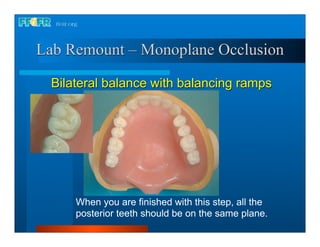 Lab Remount – Monoplane Occlusion

  Bilateral balance with balancing ramps




      When you are finished with this step, all the
      posterior teeth should be on the same plane.
 