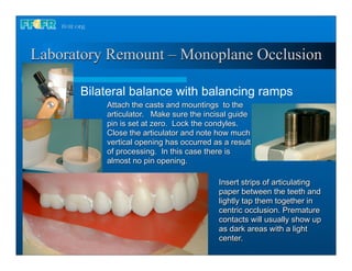 Laboratory Remount – Monoplane Occlusion

      Bilateral balance with balancing ramps
          Attach the casts and mountings to the
          articulator. Make sure the incisal guide
          pin is set at zero. Lock the condyles.
          Close the articulator and note how much
          vertical opening has occurred as a result
          of processing. In this case there is
          almost no pin opening.

                                         Insert strips of articulating
                                         paper between the teeth and
                                         lightly tap them together in
                                         centric occlusion. Premature
                                         contacts will usually show up
                                         as dark areas with a light
                                         center.
 