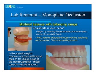 Lab Remount – Monoplane Occlusion
         Bilateral balance with balancing ramps
                     Equilibrate in excursions
                        • Begin by inserting the appropriate protrusive insert.
                        Loosen the condylar locks.
                        • Next, tract the articulator through working, balancing
                        and protrusive. This is the working position.




In the posterior region
premature contacts will may be
seen on the lingual cusps of
the mandibular teeth. These
contacts must be removed.
 
