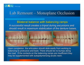 Lab Remount – Monoplane Occlusion

             Bilateral balance with balancing ramps
  A successful result creates a tripod during excursions and
  should result in maximum stabilization of the denture bases.




Protrusive                 Balancing               Working
Upon completion the articulator should slide easily from working to
balancing to protrusive and back. There should be no bumps along
the road. If the contacts on the balancing ramps are insufficient they
may be supplemented with autopolymerizing acrylic resin.
 