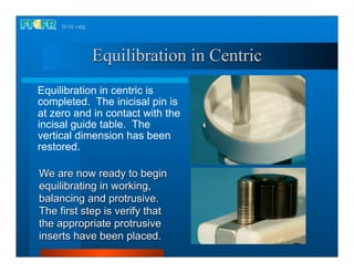 Equilibration in Centric
Equilibration in centric is
completed. The inicisal pin is
at zero and in contact with the
incisal guide table. The
vertical dimension has been
restored.

We are now ready to begin
equilibrating in working,
balancing and protrusive.
The first step is verify that
the appropriate protrusive
inserts have been placed.
 
