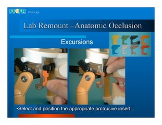 Lab Remount –Anatomic Occlusion
                     Excursions




•Select and position the appropriate protrusive insert.
 