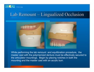 Lab Remount – Lingualized Occlusion




While performing the lab remount and equilibration procedure, the
master cast with the polymerized denture must be effectively secured to
the articulator mountings. Begin by placing notches in both the
mounting and the master cast with an acrylic burr.
 