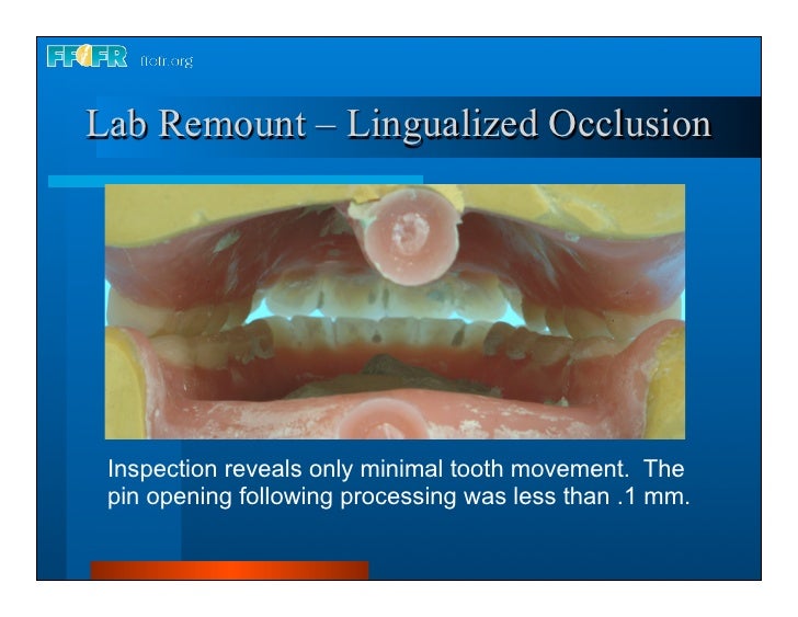 28.laboratory remount