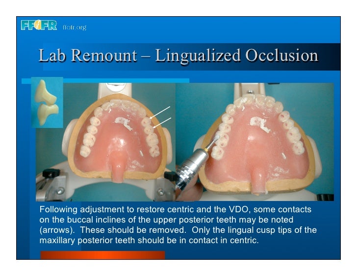 28.laboratory remount