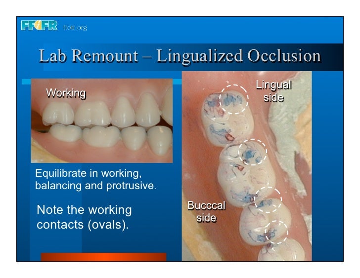 28.laboratory remount