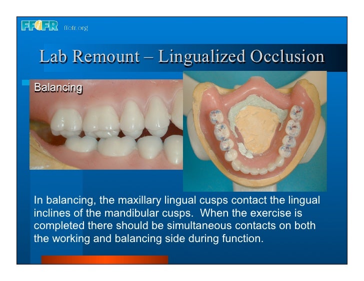 28.laboratory remount