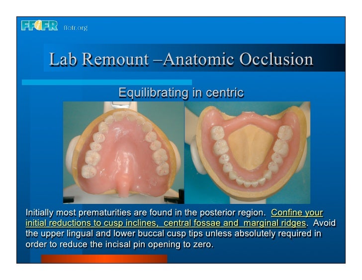 28.laboratory remount