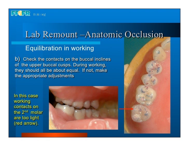 28.laboratory remount