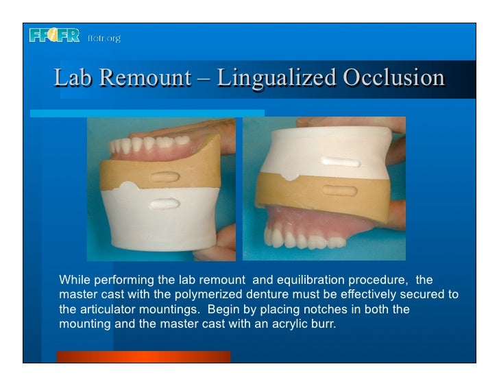 28.laboratory remount