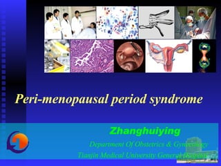 Peri-menopausal period syndrome Zhanghuiying   Department Of Obstetrics & Gynecology Tianjin Medical University General Hospital 
