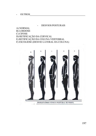 197
- OUTROS______________________________________________
- DESVIOS POSTURAIS
A) NORMAL
B) LORDOSE
C) CIFOSE
D) RETIFICAÇÃO DA CERVICAL
E) RETIFICAÇÃO DA COLUNA VERTEBRAL
F) ESCOLIOSE (DESVIO LATERAL DA COLUNA)
 