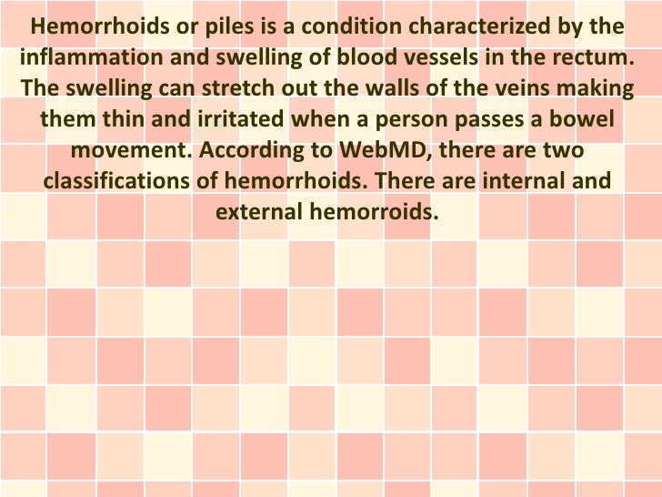 External Hemorrhoid Treatment Natural Relief From Itching and Irrit…