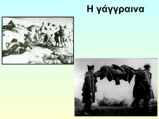 Η γάγγραινα 
 