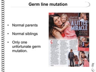 Germ line mutation
• Normal parents
• Normal siblings
• Only one
unfortunate germ
mutation.
 
