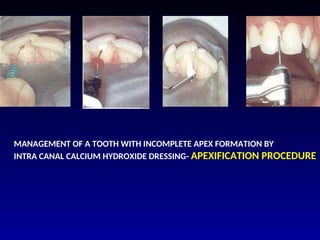 Tooth Trauma pediatric dental practical examination | PPT