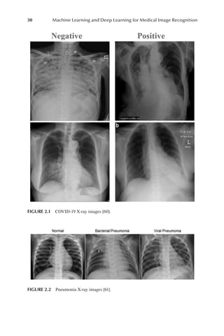 Machine Learning And Deep Learning Techniques For Medical Image ...