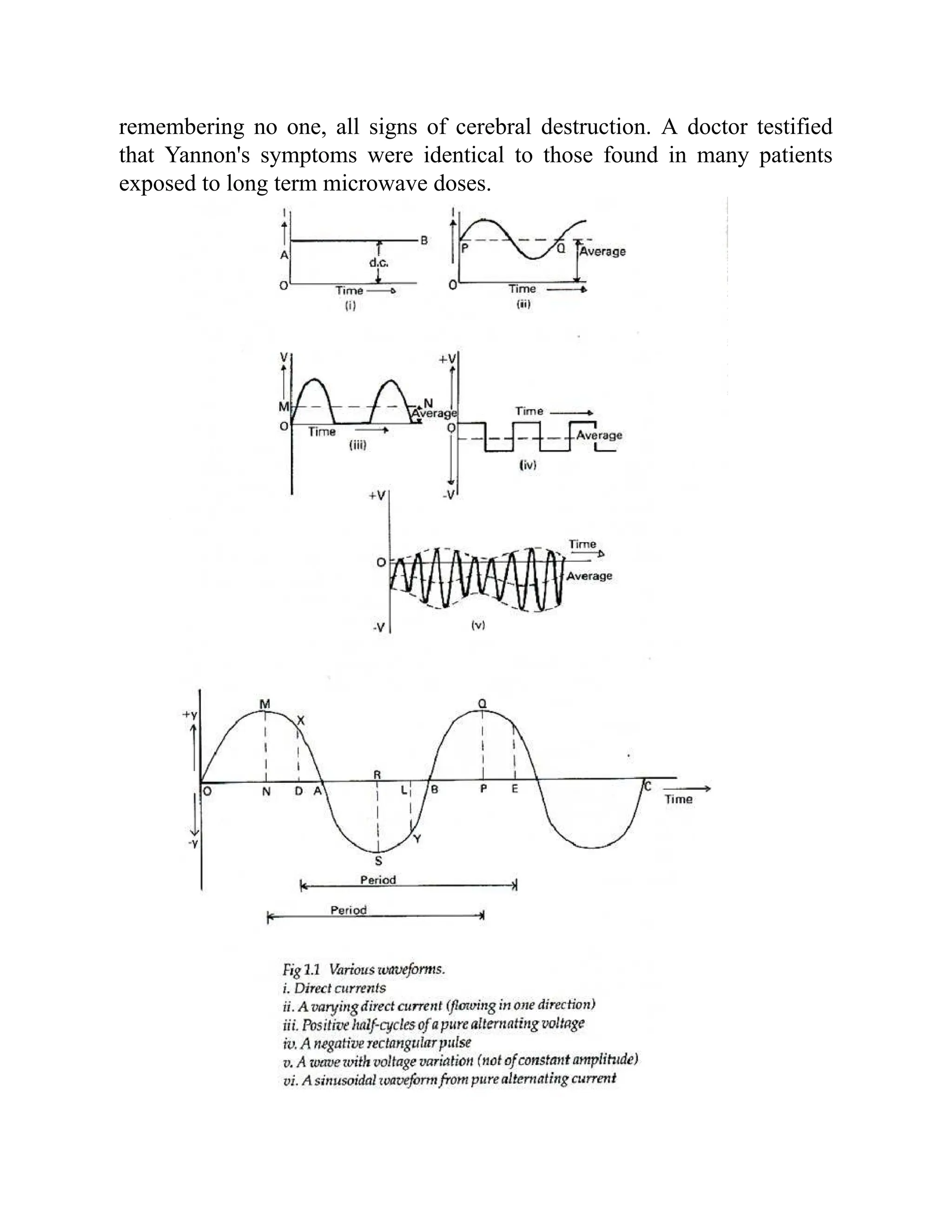 remembering no one, all signs of cerebral destruction. A doctor testified
that Yannon's symptoms were identical to those found in many patients
exposed to long term microwave doses.
 
